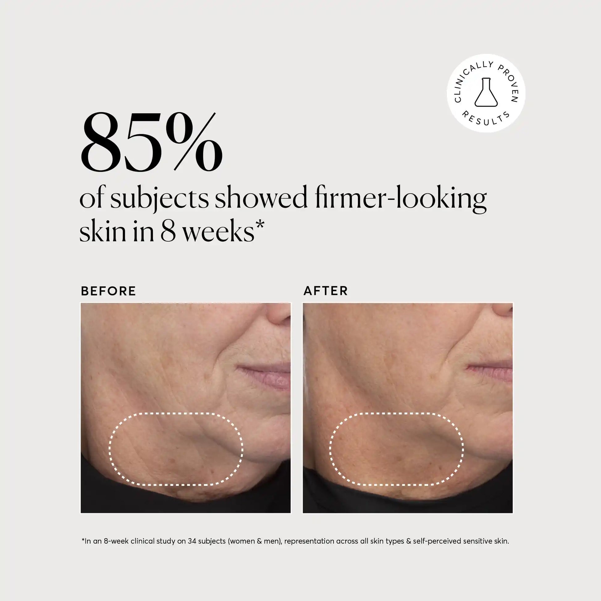 retinol-complex-serum-r5 NATR-10034-Alt-Images-Retinol-Complex-Serum-04.webp